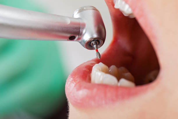 Best Urgent Dental Care in Chinook, MT